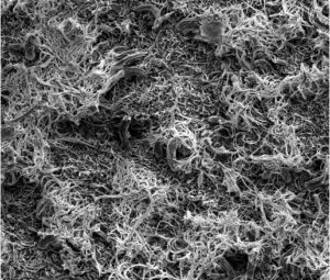 A scanning electron microscope image of threadlike wax extrusions